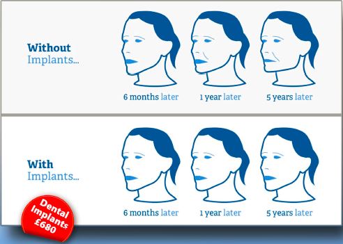Before & After Implants | Perfect Pearls